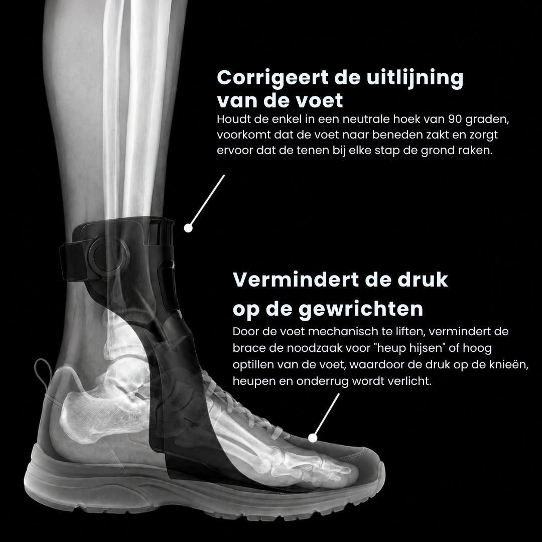 StepLift| Klapvoet Brace