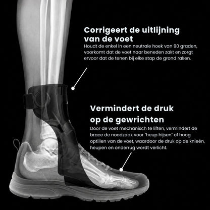 StepLift| Klapvoet Brace