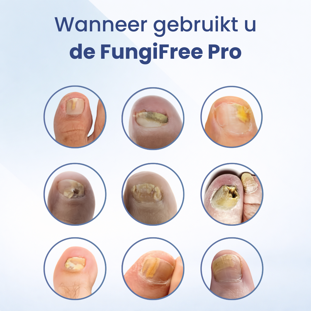 FungiFree Pro | Schimmelstopper