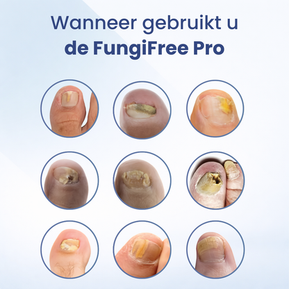 FungiFree Pro | Schimmelstopper
