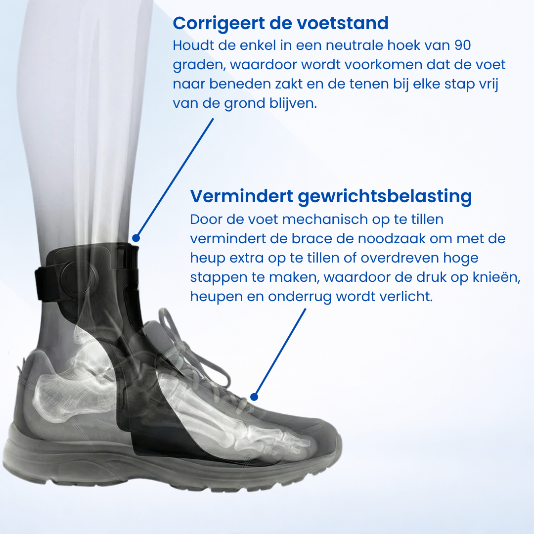 StepLift| Klapvoet Brace