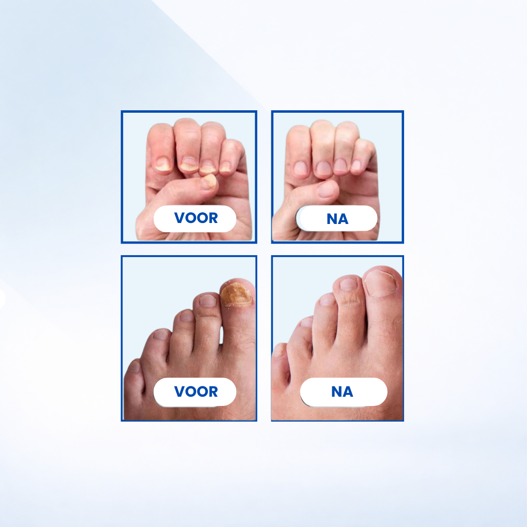 FungiFree Pro | Schimmelstopper