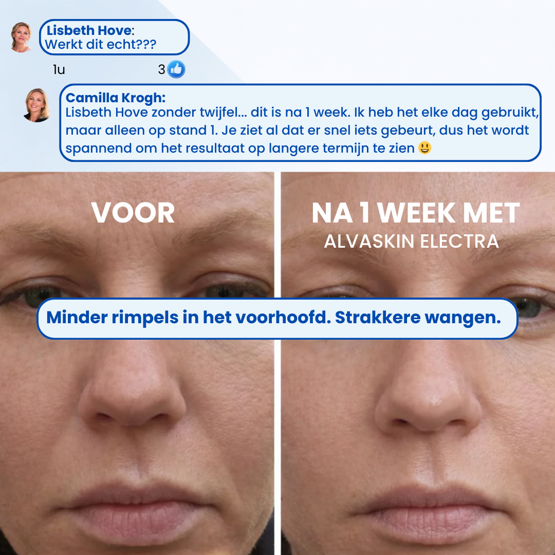 ALVASKIN Electra| Elektrische gezichtslifter