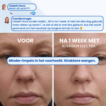 ALVASKIN Electra| Elektrische gezichtslifter