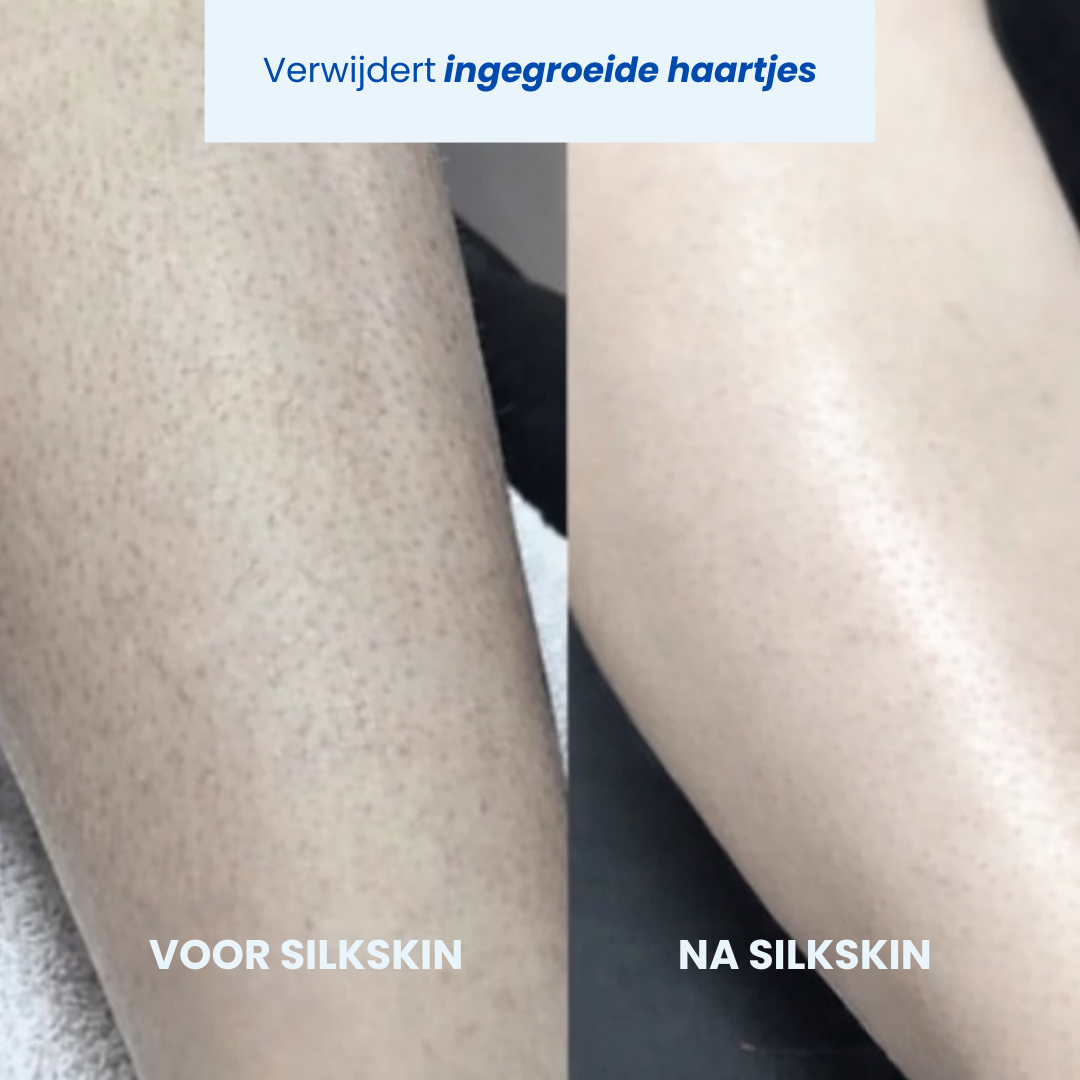 SilkSkin| 2-in-1 Intieme Trimmer