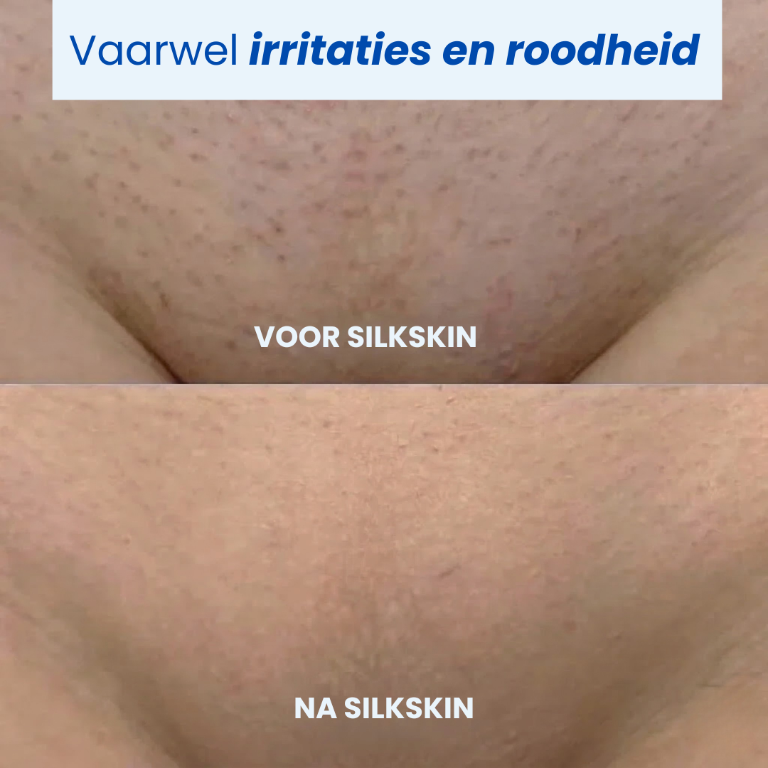 SilkSkin| 2-in-1 Intieme Trimmer